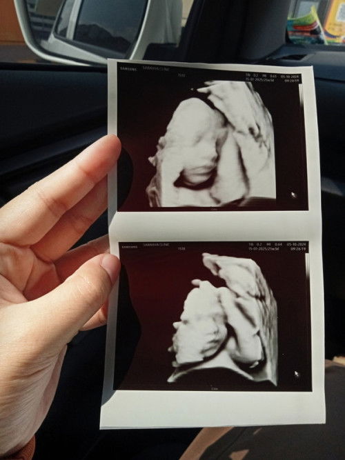 สอบถามแม่ๆ ท้องที่2คะ