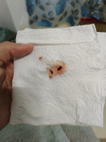 Adakah ini keguguran?