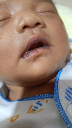 Bbir bayi menghitam