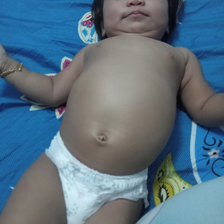 PERUT BUNCIT