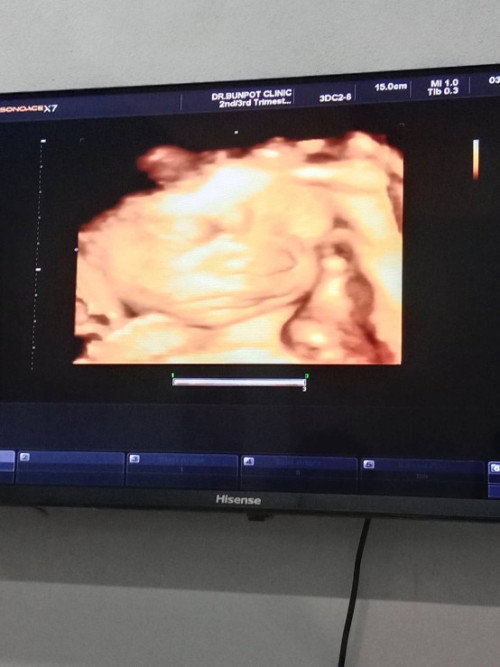 น้องดูเครียดๆไหมคะแม่ๆ🥰😂