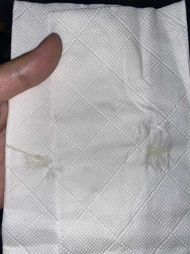 Keputihan atau mucus plus