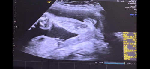 ผู้หญิง หรือผู้ชายคะแม่ๆ