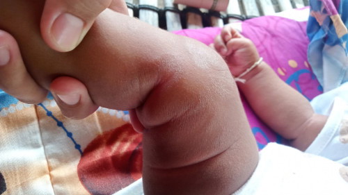 ลูกมีผิวแห้งแบบนี้ใช้อะไรหายหรือใช้ยาอะไรได้บ้าง