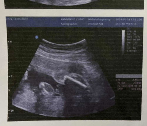 รบกวนแม่ๆช่วยดูหน่อยคะว่าน้องเพศใหน