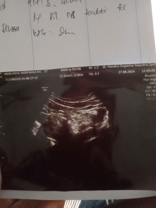 bund berbagi pengalaman ya aku tu dari bulan 6,7 ngga menst,terus aku usg di bulan 8.