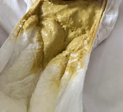 Is My Baby Poop Normal?