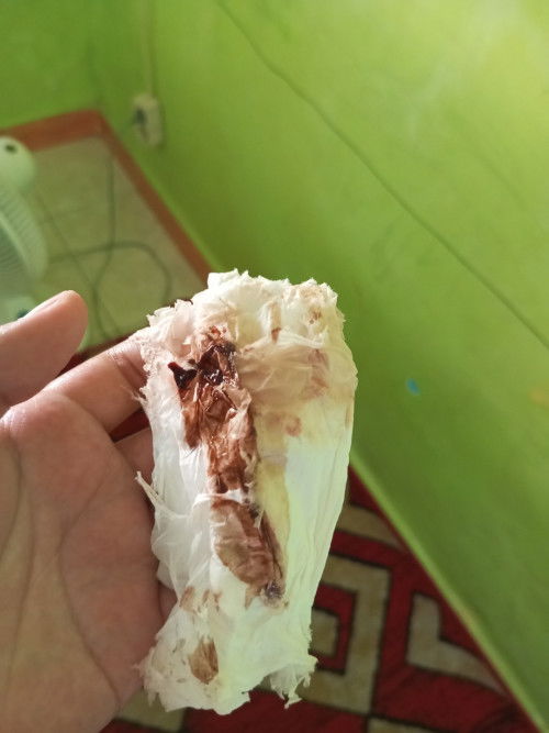 MAAF JOROK jgn pencet jika jijikan🙏.. LENDIR COKLAT, Tapi tidak kontraksi