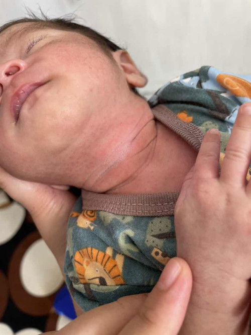 Badan dan muka bayi bintik bintik merah