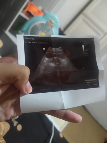 hpht nya kan 30 agust ya dok, tapi hari ini 7 okt di cek untuk kantung rahim baru setengah jdi