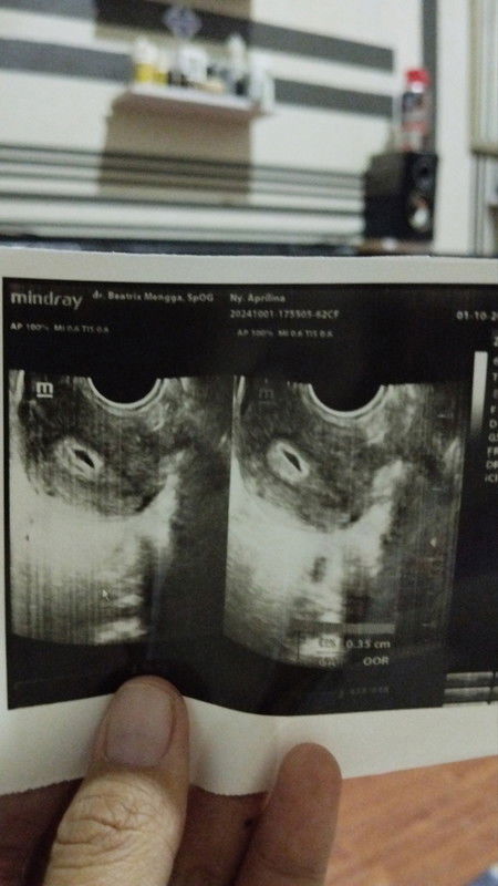 Antara bertahan dan gugur