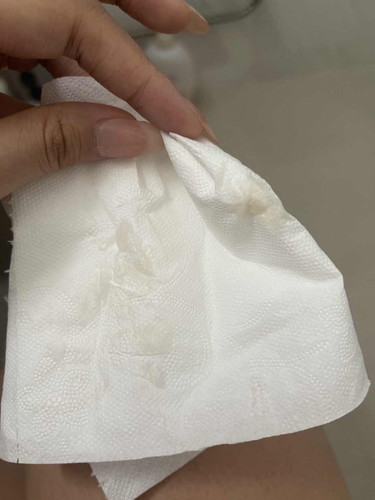 Is this a cause for concern? (TMI pics)