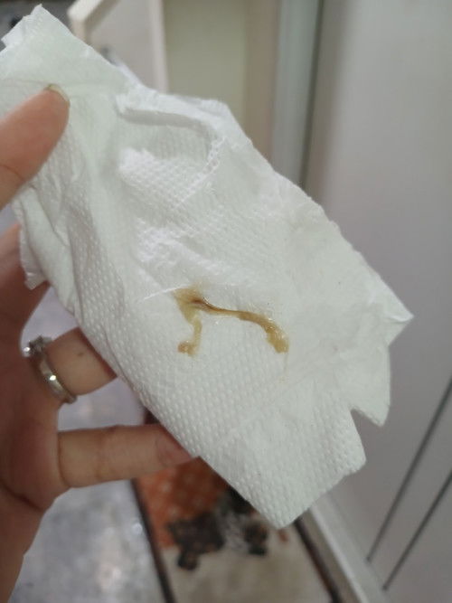 ปกติมั้ยคะใช่ถุงการตั้งครรภ์มั้ย