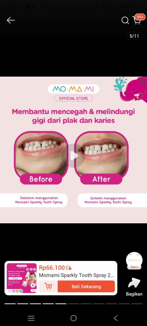 Giigi anak ada garis kuningnya