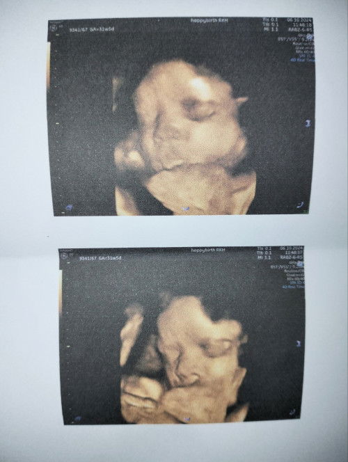 น้ำหนักลูกน้อย