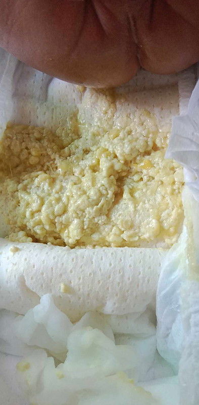 สีของอึรบกวนตอบหน่อยนะคะ