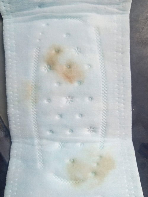 Ngflek kuning kecoklatan