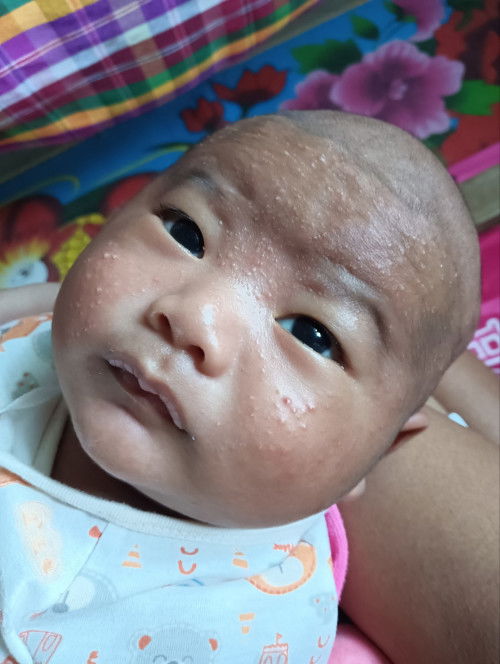 มีผื่นขึ้นแบบนี้ใช้อะไรดีคะ