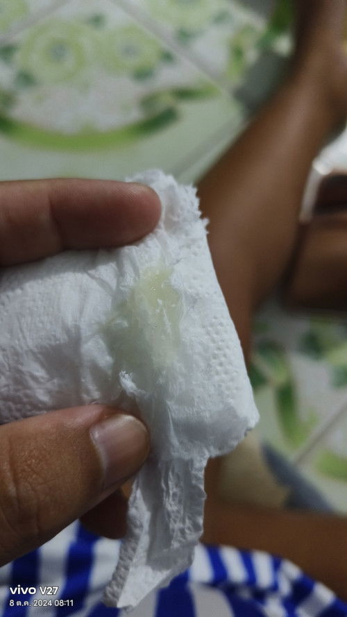 36+6วีค ใกล้คลอดหรือยัง