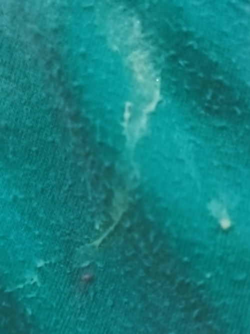 Keputihan lagi hamil