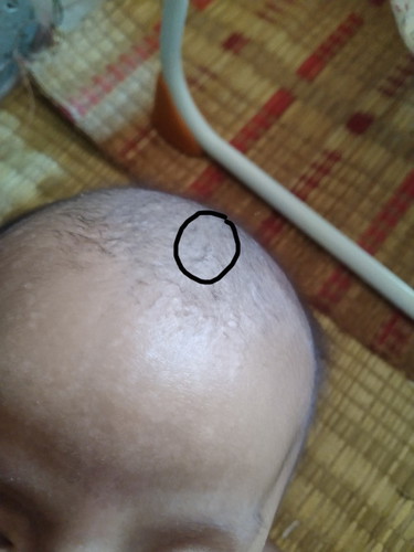 กระโหลกศีรษะ