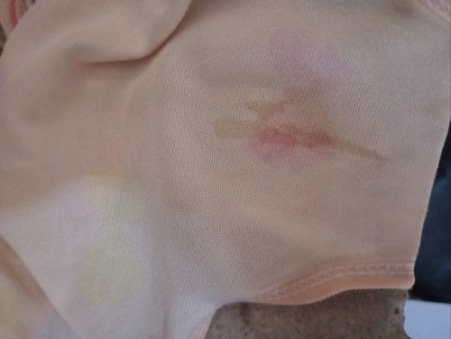 Flek di usia kehamilan 24w