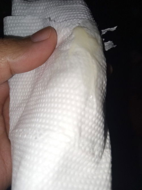 มูกใสเหนียวยืดใช่ไหมคะ