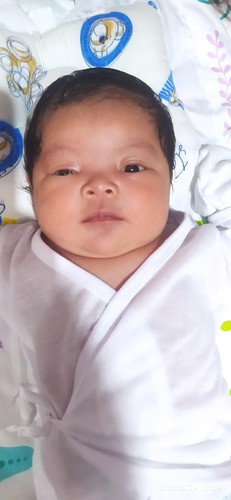 Tanong ko lang sana kung ang baby ay may conjunctivitis kelngan ba ipa checkup sa optha