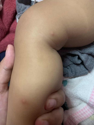 Bintat nyamuk ataupun apa ye?