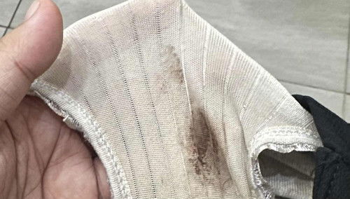 Keluar mcm benda coklat tua