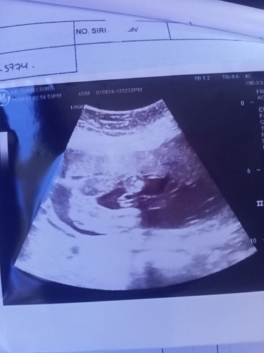 Jantina girl atau boy