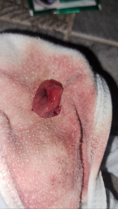 Mau nanya sma yang udah ngalamin keguguran