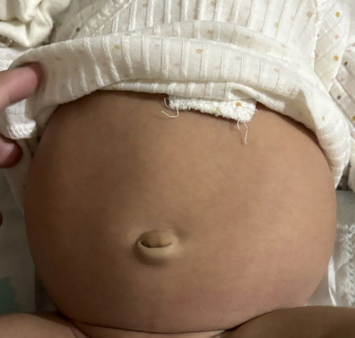 Malaking tyan ni baby