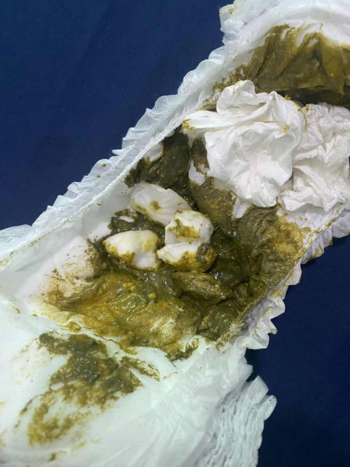 warna pup bayi 5 bulan