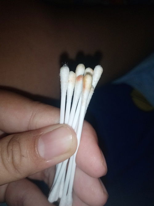 สะดือแดง ค่ะ