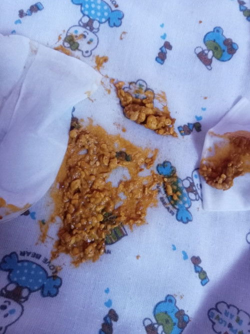 เด็ก1เดือน3วัน กินนมผงเวลาถ่ายออกมาเป็นเม็ดกระสุนอยากทราบว่าลูกเป็นอะไรไหมคะ?