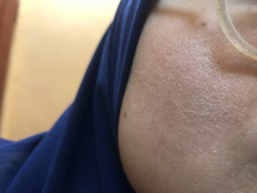 maaf lari tajuk . ada tak apa2 krim ke untuk rawat kulit muka mummy yg kering .