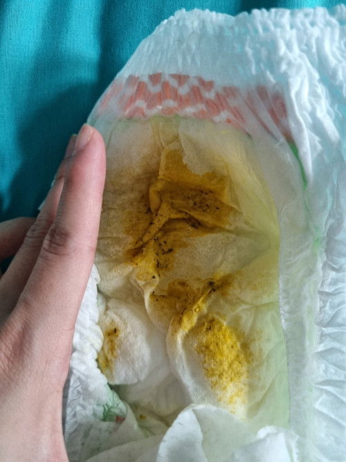 อุจจาระลูกมีสีดำเส้นๆ ปนสีเหลือง