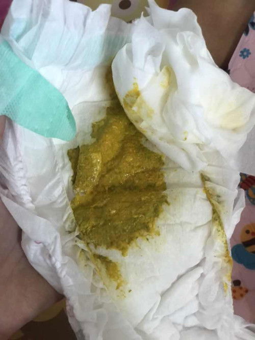 เป็นมาสอง สามวันเเล้ว