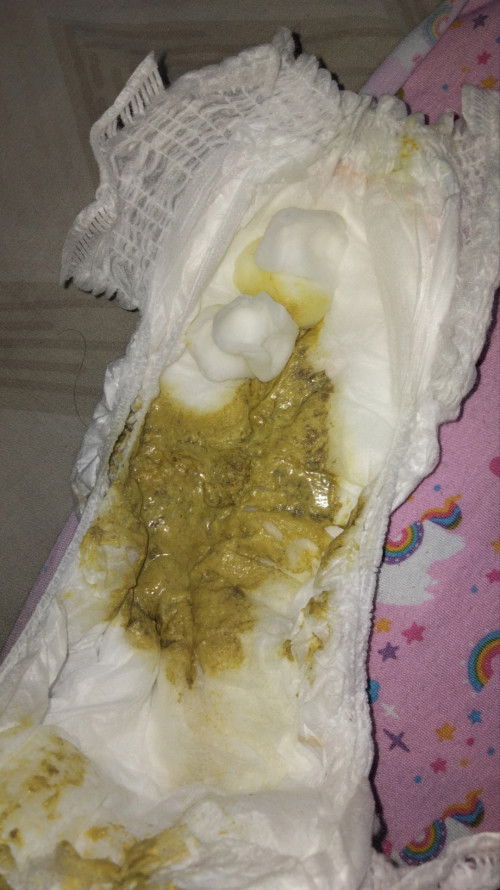 Pup anak sedang demam