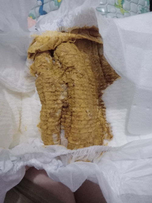 Feses bayi ganti susu