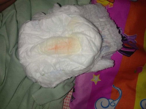 Pipis bayi ada bercak pink ke orange-orange an