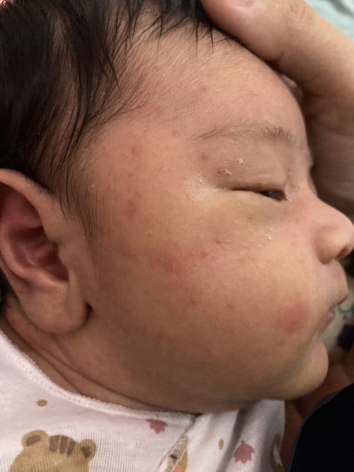 แม่ๆแนะนำวิธีรักษา หน่อยค่ะ