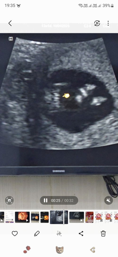 ดูเพศลูก🥰