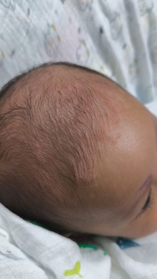 แม่ๆบ้านไหนน้องเคยเป็นแบบนี้มั้ยคะ รักษากันยังไงคะ