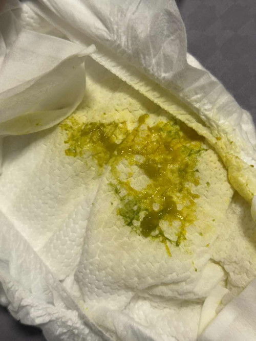 poop of a month old going 2.