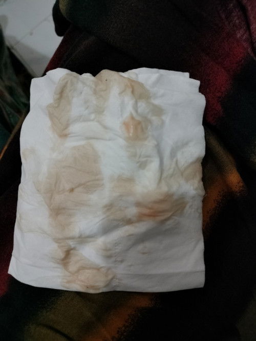 Keluar bercak seperti darah