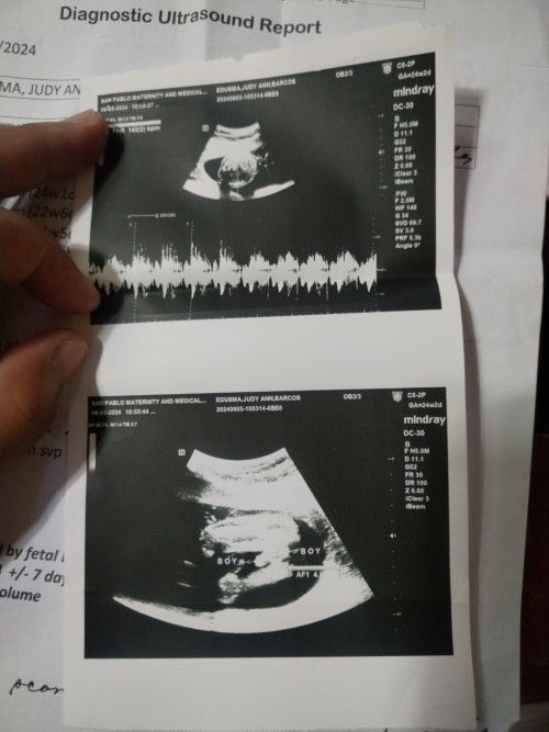 Excited na Ata lumabas baby ko 7 months Pala pero nasa baba na Siya..  Pang apat baby ko na Siya🥰