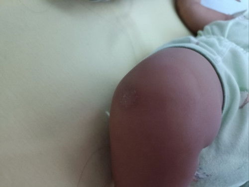 kulit bayi kayak kering mengelupas