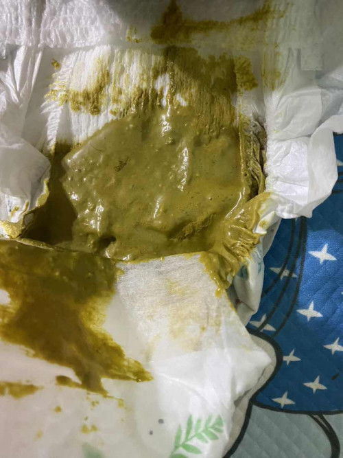 Bé nhà em 2m đi uống sct hoàn toàn đi phân như này có sao k ạ?